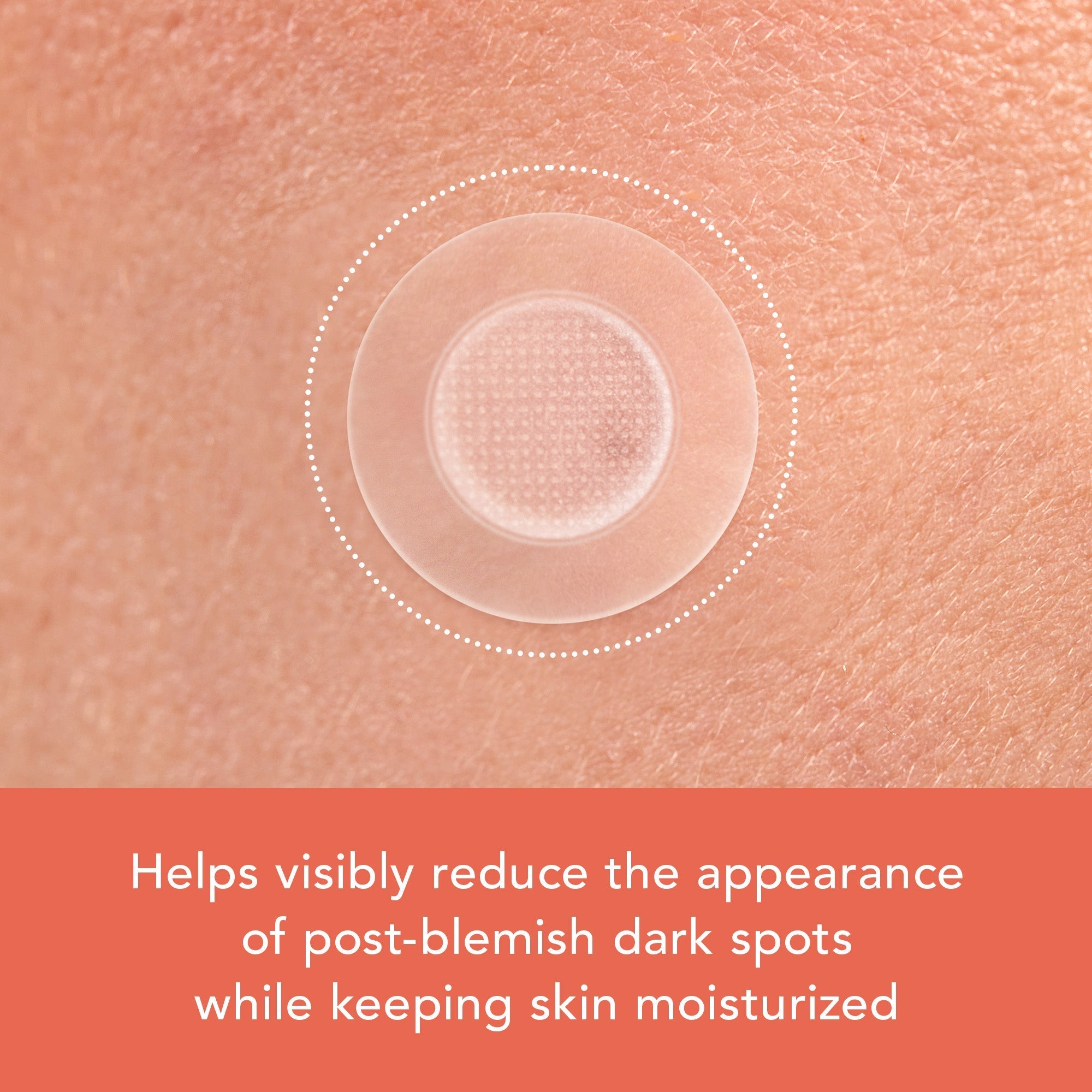 Miracle Patch Microcrystal Vitamin C Dark Spot Cover E7