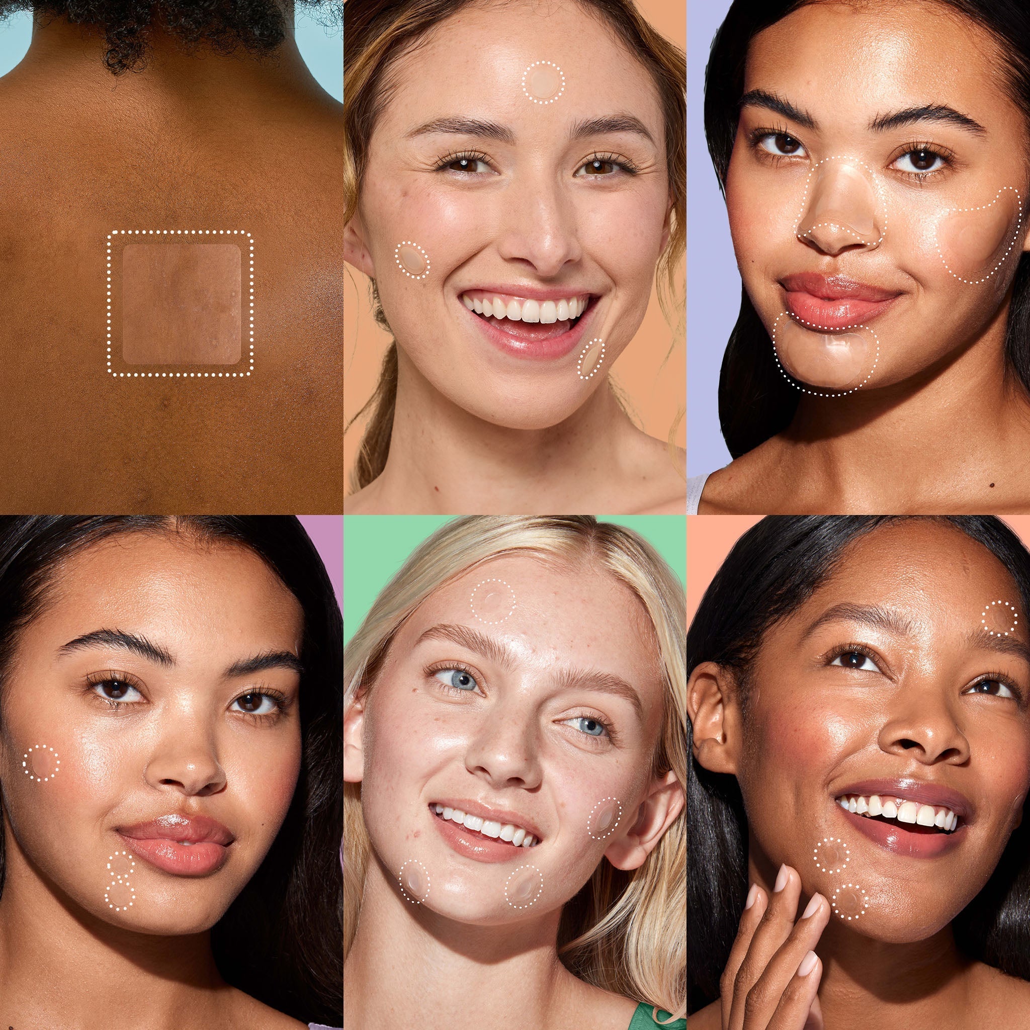 Miracle Patch Ultimate Blemish Patch Kit R6