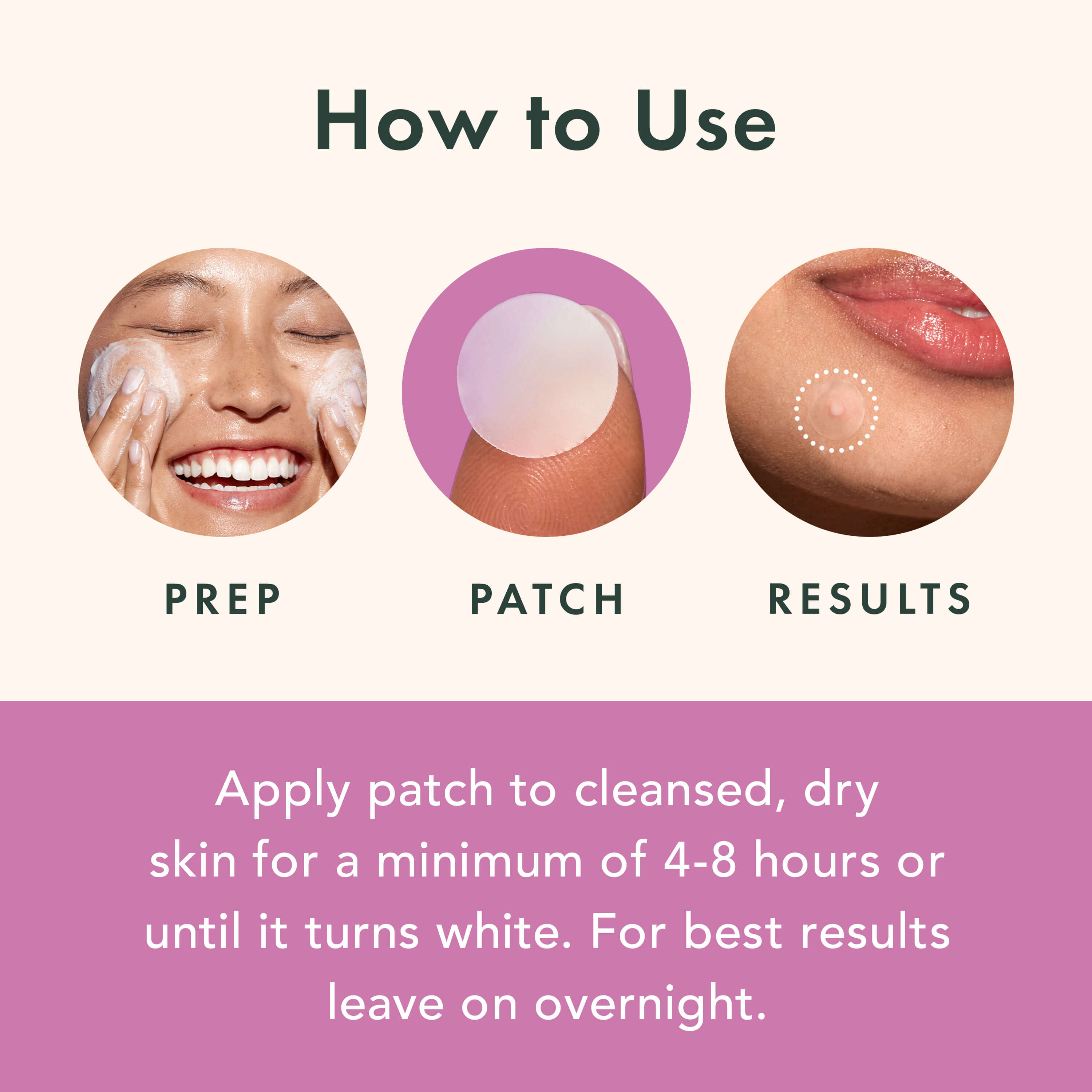 Miracle Patch Overnight Spot Cover P1
